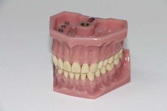 False teeth aka dentures