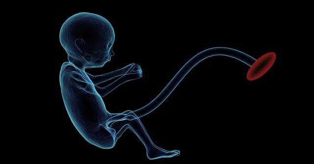 Infant